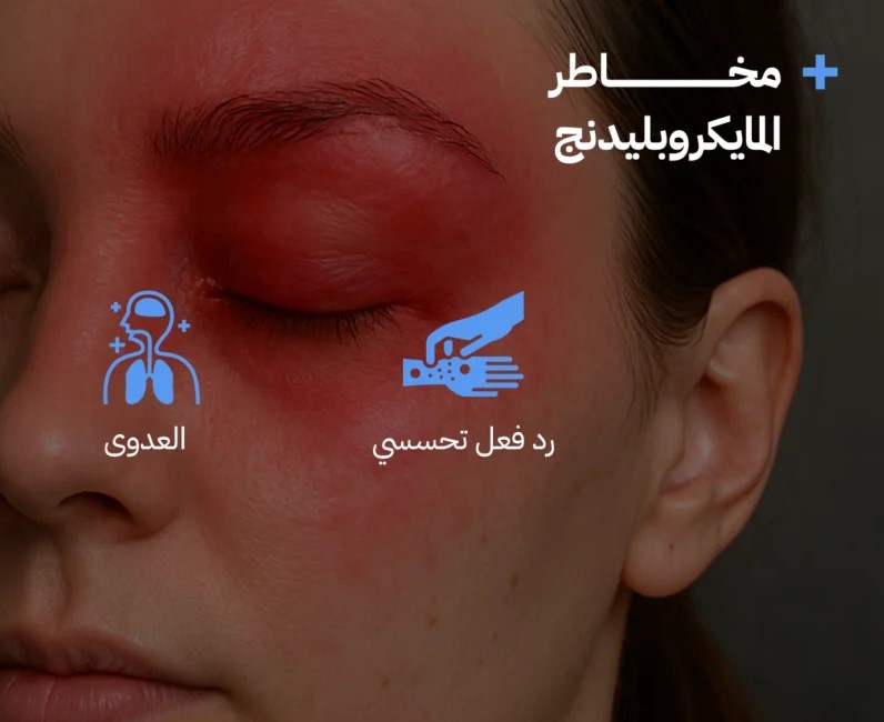 مخاطر-المايكروبليدينج