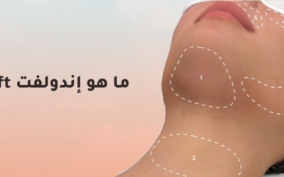 إندولفت Endolift الشد غير الجراحي