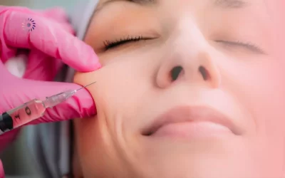 هجرة فيلر الوجه : أسبابها وعلاجها